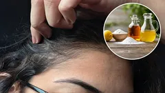 Jaké jsou výhody používání octa a jedlé sody k odstranění šedivých vlasů a jak na to správně?